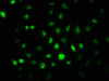 Immunofluorescence staining of A549 cells with CSB-RA007795A724phHU at 1:100,counter-stained with DAPI. The cells were fixed in 4% formaldehyde, permeabilized using 0.2% Triton X-100 and blocked in 10% normal Goat Serum. The cells were then incubated with the antibody overnight at 4°C. The secondary antibody was Alexa Fluor 488-congugated AffiniPure Goat Anti-Rabbit IgG (H+L).