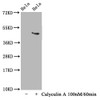 Western Blot<br />
 Positive WB detected in：Hela whole cell lysate(treated with Calyculin A or not)<br />
 All lanes：Phospho-MAPT antibody at 1.63µg/ml<br />
 Secondary<br />
 Goat polyclonal to rabbit IgG at 1/50000 dilution<br />
 Predicted band size: 46 KDa<br />
 Observed band size: 46 KDa<br />