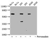 Western Blot<br />
 Positive WB detected in：Hela whole cell lysate，293 whole cell lysate，A549 whole cell lysate(treated with Pervanadate or not)<br />
 All lanes：Phospho-PTPN11 antibody at 0.65µg/ml<br />
 Secondary<br />
 Goat polyclonal to rabbit IgG at 1/50000 dilution<br />
 Predicted band size: 68 KDa<br />
 Observed band size: 68 KDa<br />