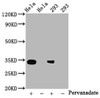 Western Blot<br />
 Positive WB detected in：Hela whole cell lysate，293 whole cell lysate(treated with Pervanadate or not)<br />
 All lanes：Phospho-CDK2 antibody at 0.8µg/ml<br />
 Secondary<br />
 Goat polyclonal to rabbit IgG at 1/50000 dilution<br />
 Predicted band size: 34 KDa<br />
 Observed band size: 34 KDa<br />