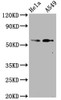 Western Blot<br />
 Positive WB detected in：Hela whole cell lysate,A549 whole cell lysate<br />
 All lanes：Phospho-SMAD2 antibody at 1.07µg/ml<br />
 Secondary<br />
 Goat polyclonal to rabbit IgG at 1/50000 dilution<br />
 Predicted band size: 58 KDa<br />
 Observed band size: 58 KDa<br />