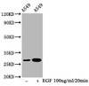 Western Blot<br />
 Positive WB detected in：A549 whole cell lysate(treated with EGF or not)<br />
 All lanes：Phospho-HSPB1 antibody at 1.5µg/ml<br />
 Secondary<br />
 Goat polyclonal to rabbit IgG at 1/50000 dilution<br />
 Predicted band size: 27 KDa<br />
 Observed band size: 27 KDa<br />