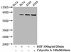 Western Blot<br />
 Positive WB detected in：Hela whole cell lysate，A549 whole cell lysate(treated with Calyculin A or EGF)<br />
 All lanes：Phospho-PRKCA antibody at 0.68µg/ml<br />
 Secondary<br />
 Goat polyclonal to rabbit IgG at 1/50000 dilution<br />
 Predicted band size: 80 KDa<br />
 Observed band size: 80 KDa<br />