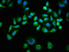 Immunofluorescence staining of Hela cells(treated with 100mM EGF for 20min) with CSB-RA001553A473phHU at 1:68,counter-stained with DAPI. The cells were fixed in 4% formaldehyde, permeabilized using 0.2% Triton X-100 and blocked in 10% normal Goat Serum. The cells were then incubated with the antibody overnight at 4°C. The secondary antibody was Alexa Fluor 488-congugated AffiniPure Goat Anti-Rabbit IgG (H+L).
