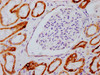 IHC image of CSB-RA009963A09phHU diluted at 1:100 and staining in paraffin-embedded human kidney tissue performed on a Leica BondTM system. After dewaxing and hydration, antigen retrieval was mediated by high pressure in a citrate buffer (pH 6.0). Section was blocked with 10% normal goat serum 30min at RT. Then primary antibody (1% BSA) was incubated at 4°C overnight. The primary is detected by a biotinylated secondary antibody and visualized using an HRP conjugated SP system.