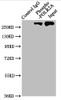 Immunoprecipitating Phospho-POLR2A in Hela whole cell lysate<br />
 Lane 1: Rabbit control IgG（1µg）instead of CSB-RA018327A02phHU in Hela whole cell lysate.
 For western blotting,a HRP-conjugated Protein G antibody was used as the secondary antibody (1/2000)<br />
 Lane 2: CSB-RA018327A02phHU（3µg）+ Hela whole cell lysate（1mg）<br />
 Lane 3: Hela whole cell lysate (20µg)<br />