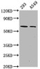 Western Blot<br />
 Positive WB detected in：293 whole cell lysate，A549 whole cell lysate<br />
 All lanes：Phospho-PRKAA2 antibody at 1.1µg/ml<br />
 Secondary<br />
 Goat polyclonal to rabbit IgG at 1/50000 dilution<br />
 Predicted band size: 62 KDa<br />
 Observed band size: 62 KDa<br />