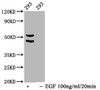 Western Blot<br />
 Positive WB detected in：293 whole cell lysate(treated with EGF or not)<br />
 All lanes：Phospho-MAPK8/MAPK9/MAPK10 antibody at 1.65µg/ml<br />
 Secondary<br />
 Goat polyclonal to rabbit IgG at 1/50000 dilution<br />
 Predicted band size: 46,54 KDa<br />
 Observed band size: 46,54 KDa<br />
