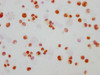 Immunocytochemistry analysis of CSB-RA013466A183phHU diluted at 1:165 and staining in Hela cells（treated with 100ng/ml EGF for 4h） performed on a Leica BondTM system. The cells were fixed in 4% formaldehyde, permeabilized using 0.2% Triton X-100 and blocked with 10% normal goat serum 30min at RT. Then primary antibody (1% BSA) was incubated at 4°C overnight. The primary is detected by a biotinylated secondary antibody and visualized using an HRP conjugated SP system.