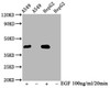 Western Blot<br />
 Positive WB detected in：A549 whole cell lysate,HepG2 whole cell lysate(treated with EGF or not)<br />
 All lanes：Phospho-MAPK3 antibody at 2.35µg/ml<br />
 Secondary<br />
 Goat polyclonal to rabbit IgG at 1/50000 dilution<br />
 Predicted band size: 42 KDa<br />
 Observed band size: 42 KDa<br />