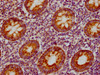 IHC image of CSB-RA859522A0HU diluted at 1:155 and staining in paraffin-embedded human appendix tissue performed on a Leica BondTM system. After dewaxing and hydration, antigen retrieval was mediated by high pressure in a citrate buffer (pH 6.0). Section was blocked with 10% normal goat serum 30min at RT. Then primary antibody (1% BSA) was incubated at 4°C overnight. The primary is detected by a biotinylated secondary antibody and visualized using an HRP conjugated SP system.