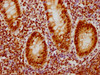 IHC image of CSB-RA858712A0HU diluted at 1:126.5 and staining in paraffin-embedded human appendix tissue performed on a Leica BondTM system. After dewaxing and hydration, antigen retrieval was mediated by high pressure in a citrate buffer (pH 6.0). Section was blocked with 10% normal goat serum 30min at RT. Then primary antibody (1% BSA) was incubated at 4°C overnight. The primary is detected by a biotinylated secondary antibody and visualized using an HRP conjugated SP system.