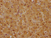 IHC image of CSB-RA009986A0HU diluted at 1:125 and staining in paraffin-embedded human liver tissue performed on a Leica BondTM system. After dewaxing and hydration, antigen retrieval was mediated by high pressure in a citrate buffer (pH 6.0). Section was blocked with 10% normal goat serum 30min at RT. Then primary antibody (1% BSA) was incubated at 4°C overnight. The primary is detected by a biotinylated secondary antibody and visualized using an HRP conjugated SP system.