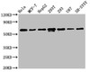 Western Blot<br />
 Positive WB detected in: Hela whole cell lysate, MCF-7 whole cell lysate, HepG2 whole cell lysate, 293T whole cell lysate, 293 whole cell lysate, U87 whole cell lysate, SH-SY5Y whole cell lysate<br />
 All lanes: HNRNPK antibody at 1.3µg/ml<br />
 Secondary<br />
 Goat polyclonal to rabbit IgG at 1/50000 dilution<br />
 Predicted band size: 51, 52, 49 KDa<br />
 Observed band size: 60 KDa<br />