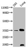Western Blot<br />
 Positive WB detected in: 293 whole cell lysate, Mouse lung tissue<br />
 All lanes: CNN1 antibody at 1.05µg/ml<br />
 Secondary<br />
 Goat polyclonal to rabbit IgG at 1/50000 dilution<br />
 Predicted band size: 34, 32 KDa<br />
 Observed band size: 34 KDa<br />