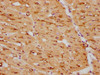 IHC image of CSB-RA005655A0HU diluted at 1:105 and staining in paraffin-embedded human heart tissue performed on a Leica BondTM system. After dewaxing and hydration, antigen retrieval was mediated by high pressure in a citrate buffer (pH 6.0). Section was blocked with 10% normal goat serum 30min at RT. Then primary antibody (1% BSA) was incubated at 4°C overnight. The primary is detected by a biotinylated secondary antibody and visualized using an HRP conjugated SP system.