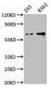Western Blot<br />
 Positive WB detected in: 293 whole cell lysate, K562 whole cell lysate<br />
 All lanes: GPC3 antibody at 0.9µg/ml<br />
 Secondary<br />
 Goat polyclonal to rabbit IgG at 1/50000 dilution<br />
 Predicted band size: 66, 60, 69 KDa<br />
 Observed band size: 66 KDa<br />