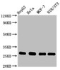 Western Blot<br />
 Positive WB detected in: HepG2 whole cell lysate, Hela whole cell lysate, MCF-7 whole cell lysate, NIH/3T3 whole cell lysate<br />
 All lanes: CDKN1B antibody at 0.9µg/ml<br />
 Secondary<br />
 Goat polyclonal to rabbit IgG at 1/50000 dilution<br />
 Predicted band size: 23 KDa<br />
 Observed band size: 27 KDa<br />