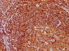 IHC image of CSB-RA005087A0HU diluted at 1:97.5 and staining in paraffin-embedded human tonsil tissue performed on a Leica BondTM system. After dewaxing and hydration, antigen retrieval was mediated by high pressure in a citrate buffer (pH 6.0). Section was blocked with 10% normal goat serum 30min at RT. Then primary antibody (1% BSA) was incubated at 4°C overnight. The primary is detected by a biotinylated secondary antibody and visualized using an HRP conjugated SP system.
