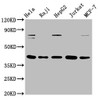 Western Blot<br />
 Positive WB detected in: Hela whole cell lysate, Raji whole cell lysate, HepG2 whole cell lysate, Jurkat whole cell lysate, MCF-7 whole cell lysate<br />
 All lanes: FEN1 antibody at 0.775µg/ml<br />
 Secondary<br />
 Goat polyclonal to rabbit IgG at 1/50000 dilution<br />
 Predicted band size: 43, 36 KDa<br />
 Observed band size: 43 KDa<br />