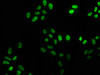 Immunofluorescence staining of Hela cells with CSB-RA008585A0HU at 1:25, counter-stained with DAPI. The cells were fixed in 4% formaldehyde, permeabilized using 0.2% Triton X-100 and blocked in 10% normal Goat Serum. The cells were then incubated with the antibody overnight at 4°C. The secondary antibody was Alexa Fluor 488-congugated AffiniPure Goat Anti-Rabbit IgG (H+L).