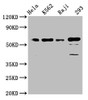 Western Blot<br />
 Positive WB detected in: Hela whole cell lysate, K562 whole cell lysate, Raji whole cell lysate, 293 whole cell lysate<br />
 All lanes: Cdc25C antibody at 1.65µg/ml<br />
 Secondary<br />
 Goat polyclonal to rabbit IgG at 1/50000 dilution<br />
 Predicted band size: 54, 52, 49, 46 KDa<br />
 Observed band size: 60 KDa<br />