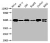 Western Blot<br />
 Positive WB detected in: Hela whole cell lysate, MCF-7 whole cell lysate, 293 whole cell lysate, HepG2 whole cell lysate, Jurkat whole cell lysate, K562 whole cell lysate<br />
 All lanes: ATF4 antibody at 1.6µg/ml<br />
 Secondary<br />
 Goat polyclonal to rabbit IgG at 1/50000 dilution<br />
 Predicted band size: 39 KDa<br />
 Observed band size: 50 KDa<br />
