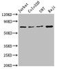 Western Blot<br />
 Positive WB detected in: Jurkat whole cell lysate, Colo320 whole cell lysate, U87 whole cell lysate, Raji whole cell lysate<br />
 All lanes: HSPA8 antibody at 1.72µg/ml<br />
 Secondary<br />
 Goat polyclonal to rabbit IgG at 1/50000 dilution<br />
 Predicted band size: 71, 54 KDa<br />
 Observed band size: 71 KDa<br />