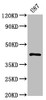 Western Blot<br />
 Positive WB detected in: U87 whole cell lysate<br />
 All lanes: PRKAR1A antibody at 1.1µg/ml<br />
 Secondary<br />
 Goat polyclonal to rabbit IgG at 1/50000 dilution<br />
 Predicted band size: 43, 39 KDa<br />
 Observed band size: 43 KDa<br />