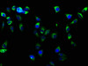 Immunofluorescence staining of Hela cells with CSB-RA011880A0HU at 1:61, counter-stained with DAPI. The cells were fixed in 4% formaldehyde, permeabilized using 0.2% Triton X-100 and blocked in 10% normal Goat Serum. The cells were then incubated with the antibody overnight at 4°C. The secondary antibody was Alexa Fluor 488-congugated AffiniPure Goat Anti-Rabbit IgG (H+L).