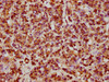 IHC image of CSB-RA010833A0HU diluted at 1:61.9 and staining in paraffin-embedded human pancreatic tissue performed on a Leica BondTM system. After dewaxing and hydration, antigen retrieval was mediated by high pressure in a citrate buffer (pH 6.0). Section was blocked with 10% normal goat serum 30min at RT. Then primary antibody (1% BSA) was incubated at 4°C overnight. The primary is detected by a biotinylated secondary antibody and visualized using an HRP conjugated SP system.