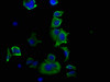 Immunofluorescence staining of MCF-7 cells with CSB-RA010833A0HU at 1:20, counter-stained with DAPI. The cells were fixed in 4% formaldehyde, permeabilized using 0.2% Triton X-100 and blocked in 10% normal Goat Serum. The cells were then incubated with the antibody overnight at 4°C. The secondary antibody was Alexa Fluor 488-congugated AffiniPure Goat Anti-Rabbit IgG (H+L).
