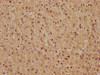 IHC image of CSB-RA008790A0HU diluted at 1:81 and staining in paraffin-embedded human adrenal gland tissue performed on a Leica BondTM system. After dewaxing and hydration, antigen retrieval was mediated by high pressure in a citrate buffer (pH 6.0). Section was blocked with 10% normal goat serum 30min at RT. Then primary antibody (1% BSA) was incubated at 4°C overnight. The primary is detected by a biotinylated secondary antibody and visualized using an HRP conjugated SP system.