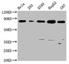 Western Blot<br />
 Positive WB detected in: Hela whole cell lysate, 293 whole cell lysate, A549 whole cell lysate, HepG2 whole cell lysate, U87 whole cell lysate<br />
 All lanes: BAG3 antibody at 0.73µg/ml<br />
 Secondary<br />
 Goat polyclonal to rabbit IgG at 1/50000 dilution<br />
 Predicted band size: 62 KDa<br />
 Observed band size: 80 KDa<br />