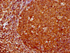 IHC image of CSB-RA008836A0HU diluted at 1:180 and staining in paraffin-embedded human tonsil tissue performed on a Leica BondTM system. After dewaxing and hydration, antigen retrieval was mediated by high pressure in a citrate buffer (pH 6.0). Section was blocked with 10% normal goat serum 30min at RT. Then primary antibody (1% BSA) was incubated at 4°C overnight. The primary is detected by a biotinylated secondary antibody and visualized using an HRP conjugated SP system.