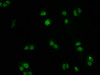 Immunofluorescence staining of PC3 cells with CSB-RA008836A0HU at 1:60, counter-stained with DAPI. The cells were fixed in 4% formaldehyde, permeabilized using 0.2% Triton X-100 and blocked in 10% normal Goat Serum. The cells were then incubated with the antibody overnight at 4°C. The secondary antibody was Alexa Fluor 488-congugated AffiniPure Goat Anti-Rabbit IgG (H+L).