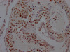 IHC image of CSB-RA222329A0HU diluted at 1:100 and staining in paraffin-embedded human testis tissue performed on a Leica BondTM system. After dewaxing and hydration, antigen retrieval was mediated by high pressure in a citrate buffer (pH 6.0). Section was blocked with 10% normal goat serum 30min at RT. Then primary antibody (1% BSA) was incubated at 4°C overnight. The primary is detected by a Goat anti-rabbit IgG polymer labeled by HRP and visualized using 0.05% DAB.