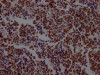 IHC image of CSB-RA222329A0HU diluted at 1:100 and staining in paraffin-embedded human lung cancer performed on a Leica BondTM system. After dewaxing and hydration, antigen retrieval was mediated by high pressure in a citrate buffer (pH 6.0). Section was blocked with 10% normal goat serum 30min at RT. Then primary antibody (1% BSA) was incubated at 4°C overnight. The primary is detected by a Goat anti-rabbit IgG polymer labeled by HRP and visualized using 0.05% DAB.