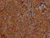 IHC image of CSB-RA575353A0HU diluted at 1:100 and staining in paraffin-embedded human adrenal gland tissue performed on a Leica BondTM system. After dewaxing and hydration, antigen retrieval was mediated by high pressure in a citrate buffer (pH 6.0). Section was blocked with 10% normal goat serum 30min at RT. Then primary antibody (1% BSA) was incubated at 4°C overnight. The primary is detected by a Goat anti-rabbit IgG polymer labeled by HRP and visualized using 0.05% DAB.