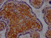 IHC image of CSB-RA213932A0HU diluted at 1:100 and staining in paraffin-embedded human placenta tissue performed on a Leica BondTM system. After dewaxing and hydration, antigen retrieval was mediated by high pressure in a citrate buffer (pH 6.0). Section was blocked with 10% normal goat serum 30min at RT. Then primary antibody (1% BSA) was incubated at 4°C overnight. The primary is detected by a Goat anti-rabbit IgG polymer labeled by HRP and visualized using 0.05% DAB.