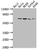 Western Blot<br />
 Positive WB detected in: Raji whole cell lysate, Hela whole cell lysate, HL60 whole cell lysate, Jurkat whole cell lysate, A549 whole cell lysate<br />
 All lanes: PRMT5 antibody at 1:2000<br />
 Secondary<br />
 Goat polyclonal to rabbit IgG at 1/50000 dilution<br />
 Predicted band size: 73, 72, 54, 68, 67 kDa<br />
 Observed band size: 73 kDa<br />