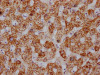 IHC image of CSB-RA953395A0HU diluted at 1:100 and staining in paraffin-embedded human liver tissue performed on a Leica BondTM system. After dewaxing and hydration, antigen retrieval was mediated by high pressure in a citrate buffer (pH 6.0). Section was blocked with 10% normal goat serum 30min at RT. Then primary antibody (1% BSA) was incubated at 4°C overnight. The primary is detected by a Goat anti-rabbit IgG polymer labeled by HRP and visualized using 0.05% DAB.