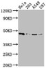 Western Blot<br />
 Positive WB detected in: Hela whole cell lysate, 293 whole cell lysate, A549 whole cell lysate, U87 whole cell lysate<br />
 All lanes: MAP2K1 antibody at 1:2000<br />
 Secondary<br />
 Goat polyclonal to rabbit IgG at 1/50000 dilution<br />
 Predicted band size: 44, 41 kDa<br />
 Observed band size: 44 kDa<br />