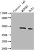 Immunoprecipitating MAP2K1 in Hela whole cell lysate<br />
 Lane 1: Rabbit control IgG instead of CSB-RA225579A0HU in Hela whole cell lysate.
 For western blotting,a HRP-conjugated Protein G antibody was used as the secondary antibody (1/2000)<br />
 Lane 2: CSB-RA225579A0HU（2µg）+ Hela whole cell lysate（500µg）<br />
 Lane 3: Hela whole cell lysate (10µg)<br />