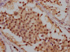 IHC image of CSB-RA166706A0HU diluted at 1:100 and staining in paraffin-embedded human testis tissue performed on a Leica BondTM system. After dewaxing and hydration, antigen retrieval was mediated by high pressure in a citrate buffer (pH 6.0). Section was blocked with 10% normal goat serum 30min at RT. Then primary antibody (1% BSA) was incubated at 4°C overnight. The primary is detected by a Goat anti-rabbit IgG polymer labeled by HRP and visualized using 0.05% DAB.