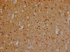 IHC image of CSB-RA246354A0HU diluted at 1:100 and staining in paraffin-embedded human brain tissue performed on a Leica BondTM system. After dewaxing and hydration, antigen retrieval was mediated by high pressure in a citrate buffer (pH 6.0). Section was blocked with 10% normal goat serum 30min at RT. Then primary antibody (1% BSA) was incubated at 4°C overnight. The primary is detected by a Goat anti-rabbit IgG polymer labeled by HRP and visualized using 0.05% DAB.