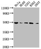 Western Blot<br />
 Positive WB detected in: Hela whole cell lysate, HL60 whole cell lysate, U251 whole cell lysate, K562 whole cell lysate, 293T whole cell lysate<br />
 All lanes: HDAC3 antibody at 1:2000<br />
 Secondary<br />
 Goat polyclonal to rabbit IgG at 1/50000 dilution<br />
 Predicted band size: 49, 50 kDa<br />
 Observed band size: 49 kDa<br />