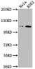 Western Blot<br />
 Positive WB detected in: Hela whole cell lysate, K562 whole cell lysate<br />
 All lanes: PIK3CB antibody at 1:1500<br />
 Secondary<br />
 Goat polyclonal to rabbit IgG at 1/50000 dilution<br />
 Predicted band size: 123 kDa<br />
 Observed band size: 110 kDa<br />