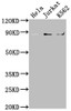 Western Blot<br />
 Positive WB detected in: Hela whole cell lysate, Jurkat whole cell lysate, K562 whole cell lysate<br />
 All lanes: IKBKB antibody at 1:2000<br />
 Secondary<br />
 Goat polyclonal to rabbit IgG at 1/50000 dilution<br />
 Predicted band size: 87, 86, 30, 80 kDa<br />
 Observed band size: 87 kDa<br />