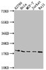 Western Blot<br />
 Positive WB detected in: A2780 whole cell lysate, Hela whole cell lysate, MCF-7 whole cell lysate, Jurkat whole cell lysate, Raji whole cell lysate<br />
 All lanes: EIF5A antibody at 1:2000<br />
 Secondary<br />
 Goat polyclonal to rabbit IgG at 1/50000 dilution<br />
 Predicted band size: 17, 21 kDa<br />
 Observed band size: 18 kDa<br />